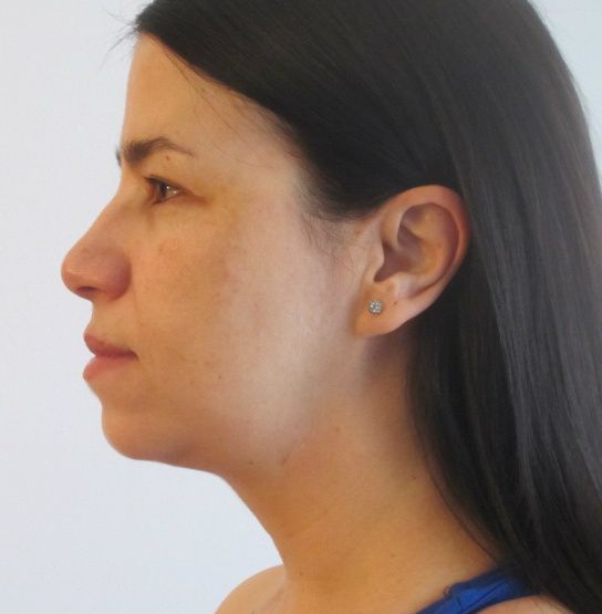Loulous ageless facial exercises Spunk lover powered by phpbb